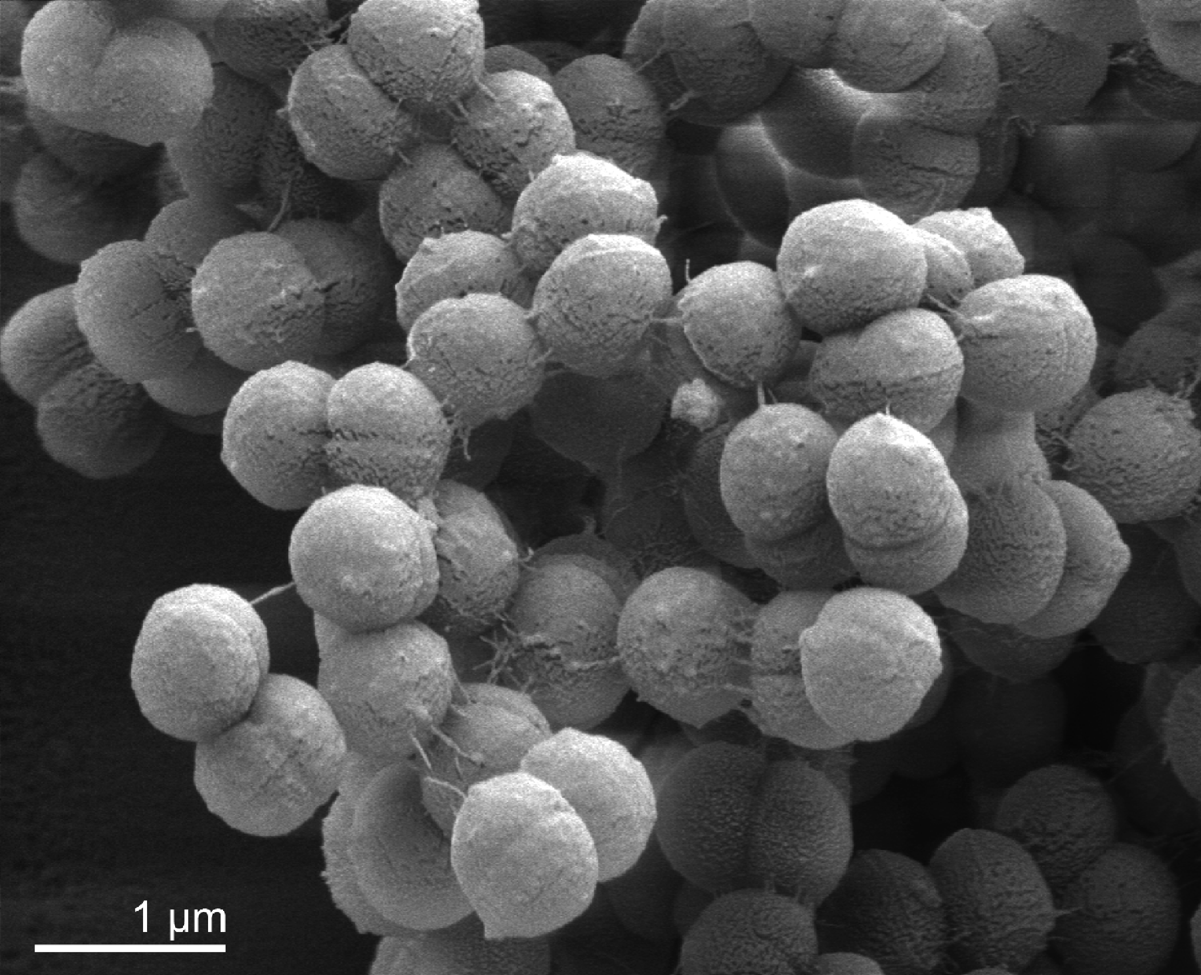 Представитель Семейства Peptostreptococcaceae